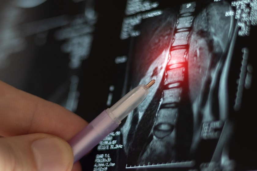 Doctor Examining Spine X-Ray